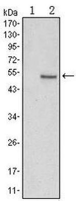 SUZ12 Antibody in Western Blot (WB)