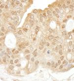 SYK Antibody in Immunohistochemistry (IHC)