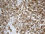 SYNE1 Antibody in Immunohistochemistry (Paraffin) (IHC (P))