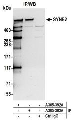 SYNE2/Nesprin 2 Antibody in Immunoprecipitation (IP)