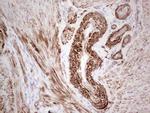 SYNM Antibody in Immunohistochemistry (Paraffin) (IHC (P))