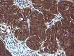 SYP Antibody in Immunohistochemistry (Paraffin) (IHC (P))