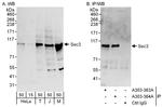 Sec3 Antibody in Western Blot (WB)