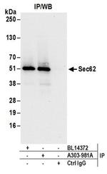 Sec62 Antibody in Western Blot (WB)