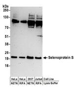 Selenoprotein S Antibody in Western Blot (WB)