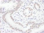 Sm-D3 Antibody in Immunohistochemistry (IHC)