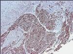 Smoothelin Antibody in Immunohistochemistry (Paraffin) (IHC (P))