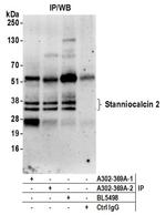Stanniocalcin 2 Antibody in Western Blot (WB)