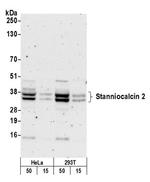 Stanniocalcin 2 Antibody in Western Blot (WB)