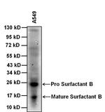 SFTPB Antibody in Western Blot (WB)