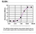 XPC Antibody in ELISA (ELISA)