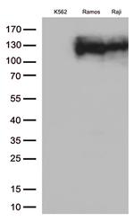 CD10 (MME) Antibody in Western Blot (WB)