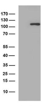 ERAP1 Antibody in Western Blot (WB)