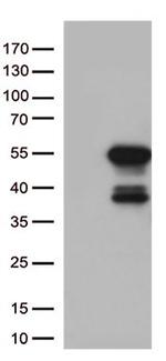 MTRF1 Antibody in Western Blot (WB)