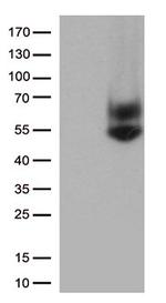 FCGR3A Antibody in Western Blot (WB)