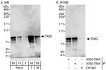 TAB2 Antibody in Western Blot (WB)