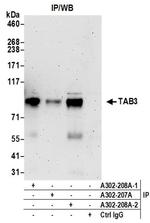 TAB3 Antibody in Immunoprecipitation (IP)