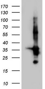 TACC2 Antibody in Western Blot (WB)