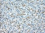 TACC3 Antibody in Immunohistochemistry (Paraffin) (IHC (P))