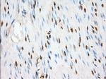 TACC3 Antibody in Immunohistochemistry (Paraffin) (IHC (P))