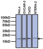 TAF12 Antibody in Western Blot (WB)