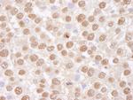 TAFII68 Antibody in Immunohistochemistry (IHC)