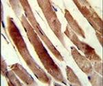 TAGLN Antibody in Immunohistochemistry (IHC)