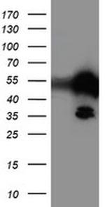 TAL1 Antibody in Western Blot (WB)