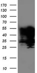 TAL1 Antibody in Western Blot (WB)