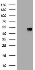 TAPBPL Antibody in Western Blot (WB)