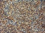 TBC1D21 Antibody in Immunohistochemistry (Paraffin) (IHC (P))