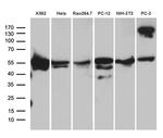 TBL1XR1 Antibody in Western Blot (WB)