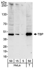 TBP Antibody in Western Blot (WB)