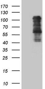 TBX3 Antibody in Western Blot (WB)