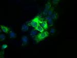 TBXAS Antibody in Immunocytochemistry (ICC/IF)