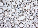 TBXAS Antibody in Immunohistochemistry (Paraffin) (IHC (P))