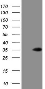 TCEAL1 Antibody in Western Blot (WB)