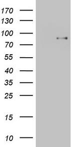 TCF12 Antibody in Western Blot (WB)