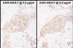 TCP1 Antibody in Immunohistochemistry (IHC)