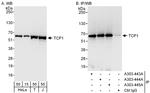 TCP1 Antibody in Western Blot (WB)