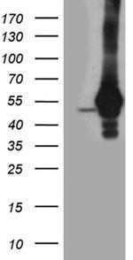 TDP2 Antibody in Western Blot (WB)