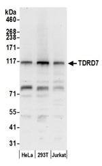 TDRD7 Antibody in Western Blot (WB)