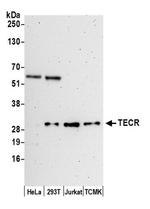 TECR Antibody in Western Blot (WB)