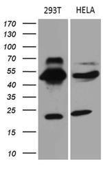 TEKT2 Antibody in Western Blot (WB)