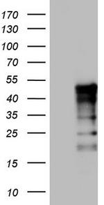 TET3 Antibody in Western Blot (WB)