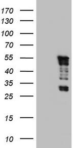 TET3 Antibody in Western Blot (WB)