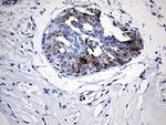 TFF1 Antibody in Immunohistochemistry (Paraffin) (IHC (P))