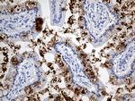 TFF1 Antibody in Immunohistochemistry (Paraffin) (IHC (P))