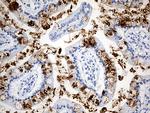 TFF1 Antibody in Immunohistochemistry (Paraffin) (IHC (P))