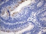 TFF1 Antibody in Immunohistochemistry (Paraffin) (IHC (P))